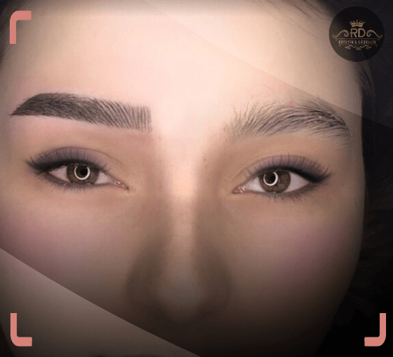 8T Nano Pigmentasyon