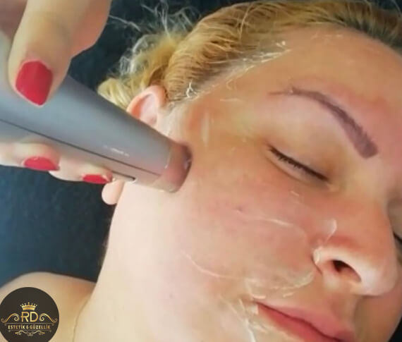 İğnesiz Mezoterapi